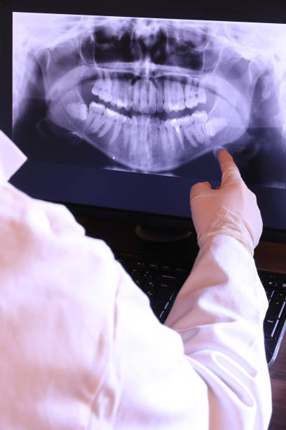 Best Emergency Treatment for Dental Infections or Abscesses in Waimanalo, HI